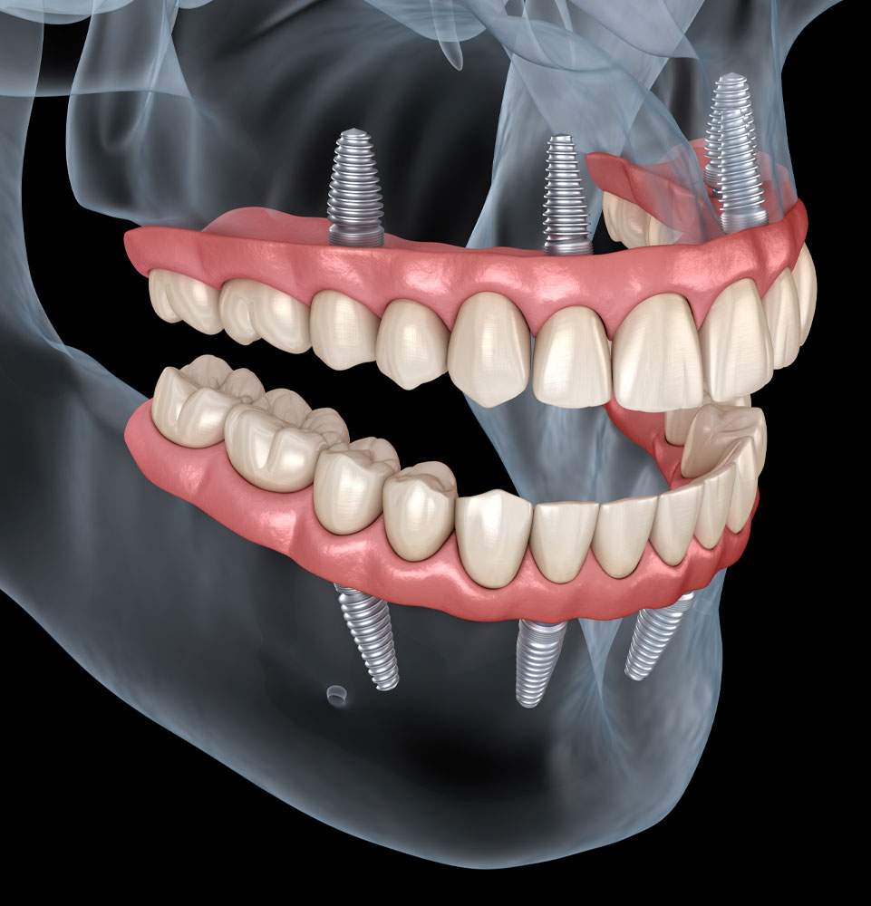 all on x 3d model